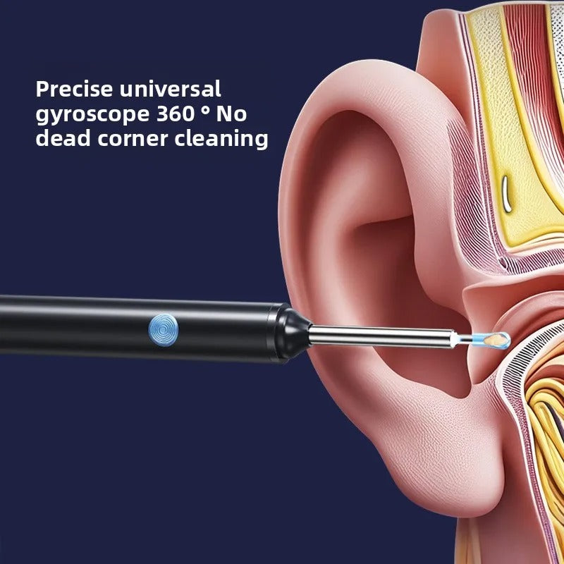 Earwax Removal Kit