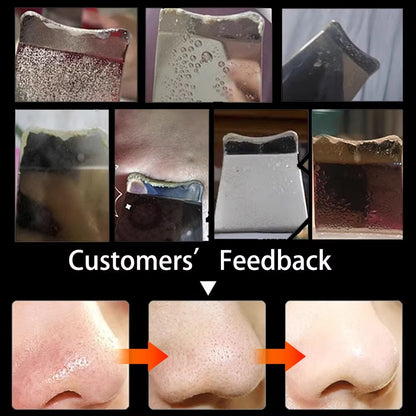 Ultrasonic Skin Scrubber