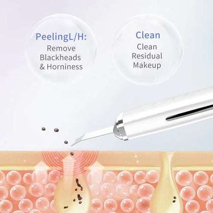 Ultrasonic Skin Scrubber